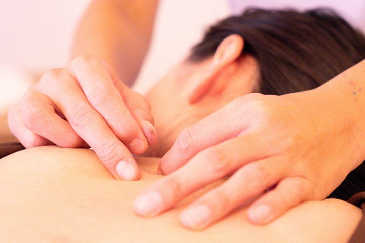 Japanese Acupuncture and Massage in Shibuya Tokyo Private