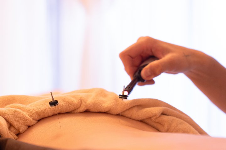 Japanese Acupuncture and Massage in Shibuya Tokyo Private